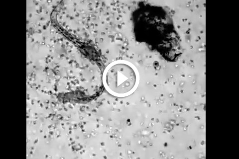 système immunitaire globules blancs attaquent un parasite